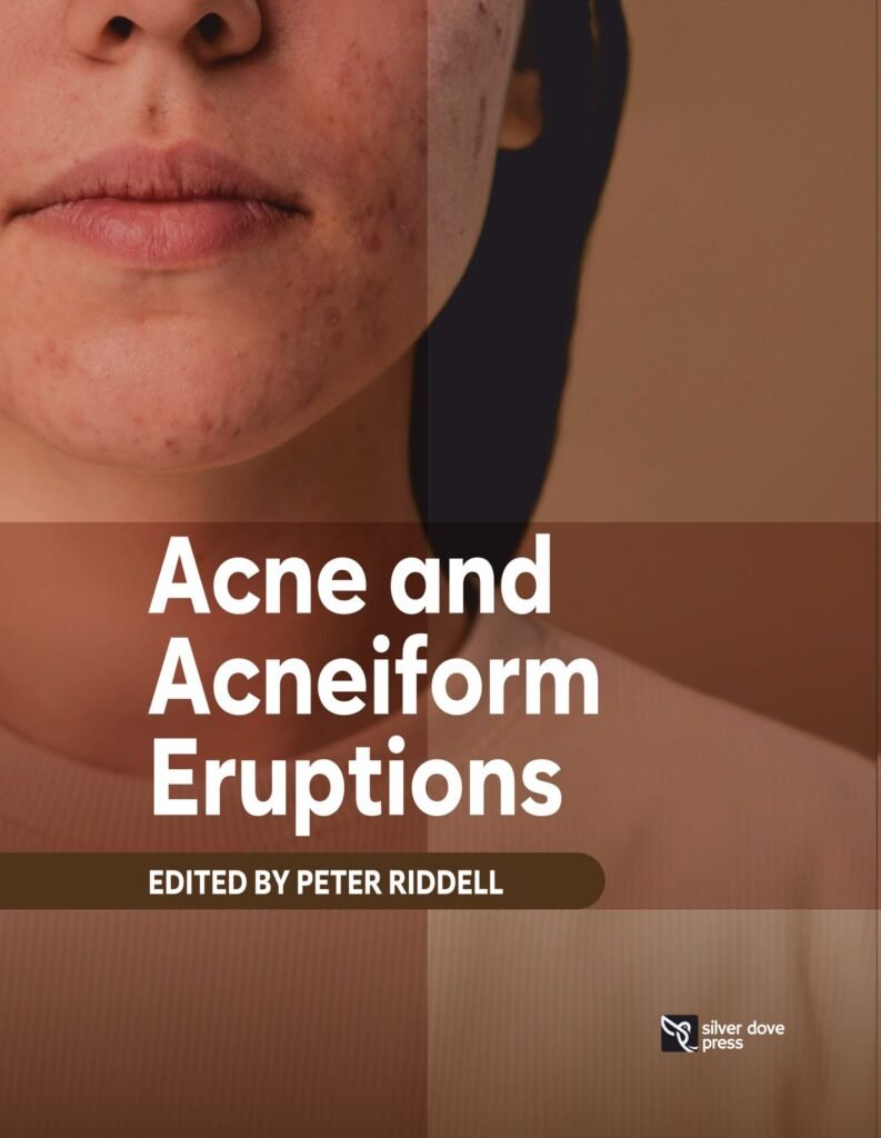 Acne and Acneiform Eruptions