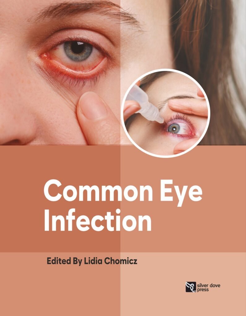Common Eye Infection