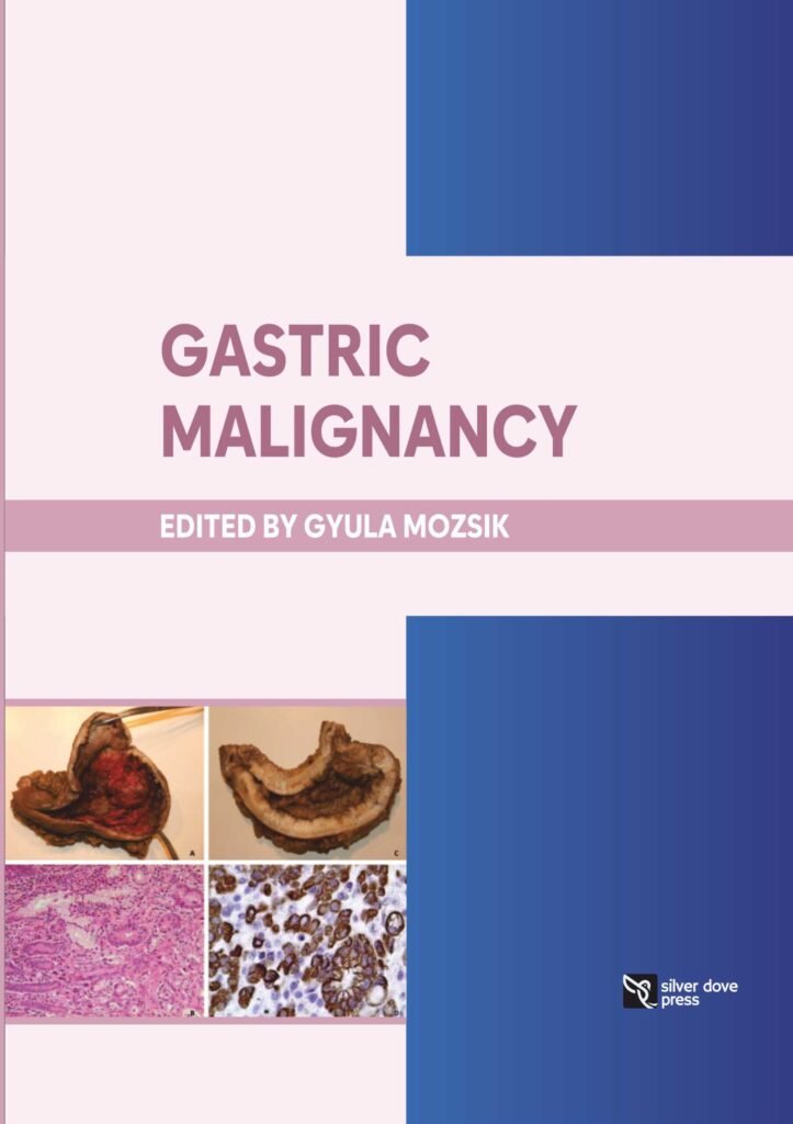 Gastric Malignancy