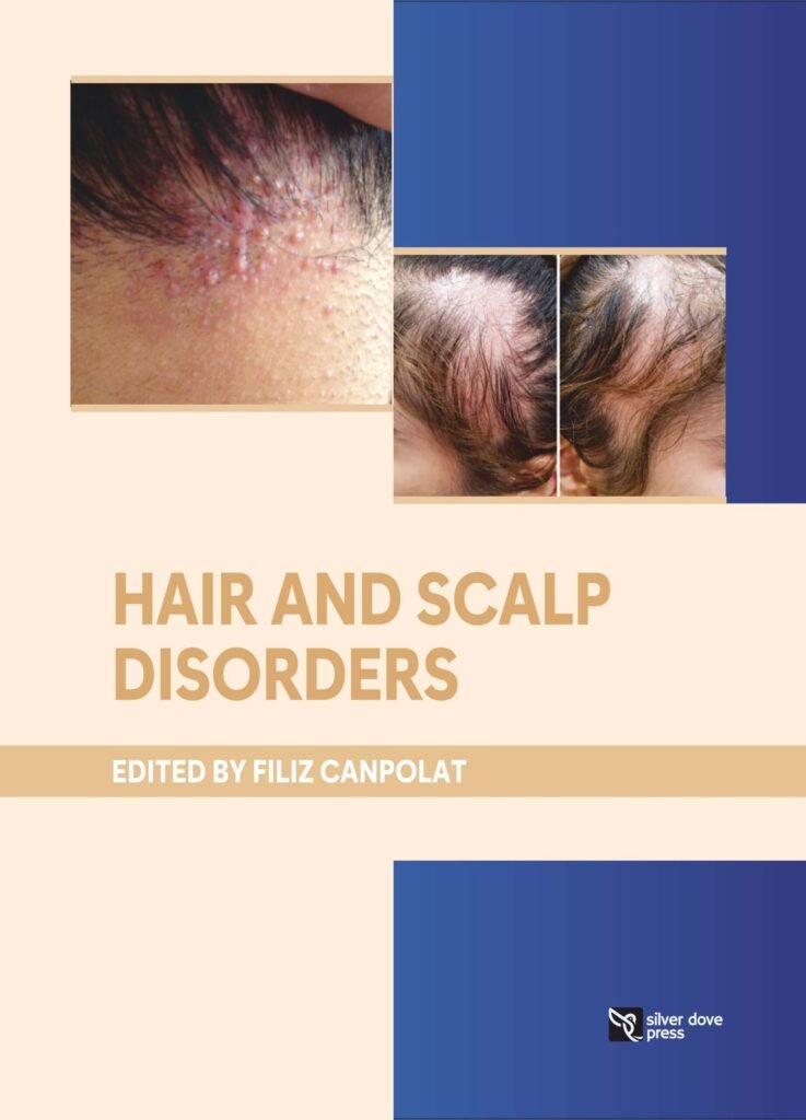 Hair and Scalp Disorders