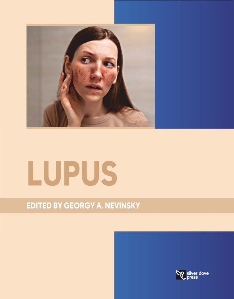 Lupus