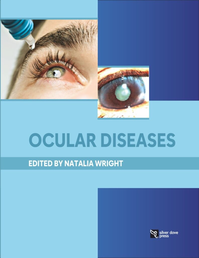 Ocular Diseases