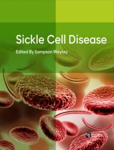 Sickle Cell Disease