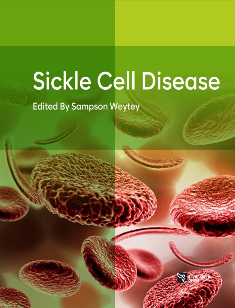 Sickle Cell Disease