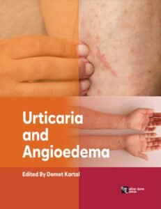 Urticaria and Angioedema