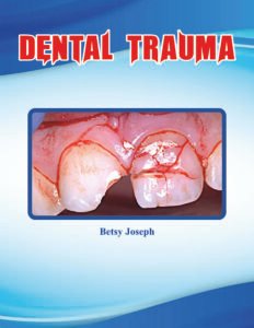 Dental Trauma