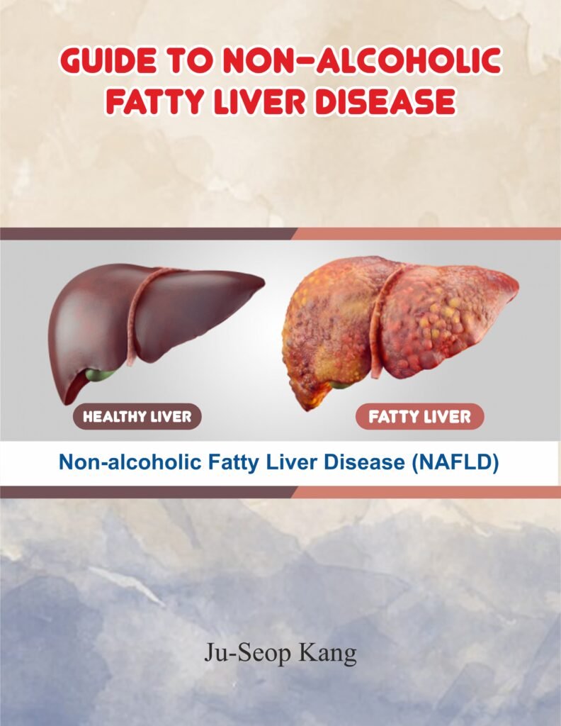Guide to Non-Alcoholic Fatty Liver Disease