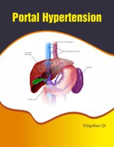 Portal Hypertension