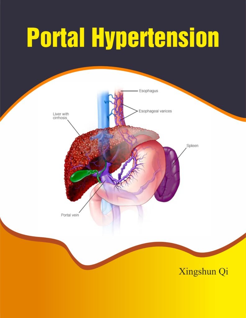 Portal Hypertension