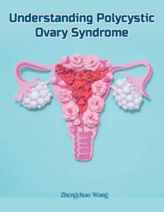 Understanding Polycystic Ovary Syndrome