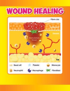 Wound Healing